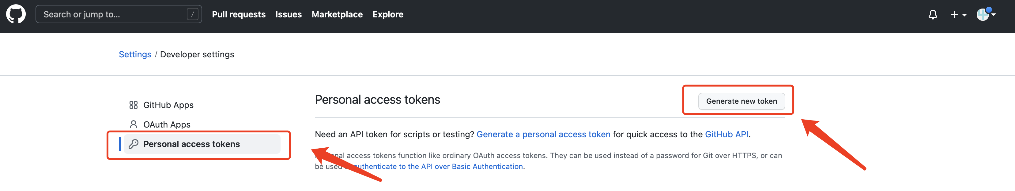 image-20220917145514616